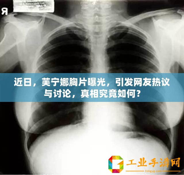 近日，芙寧娜胸片曝光，引發網友熱議與討論，真相究竟如何？