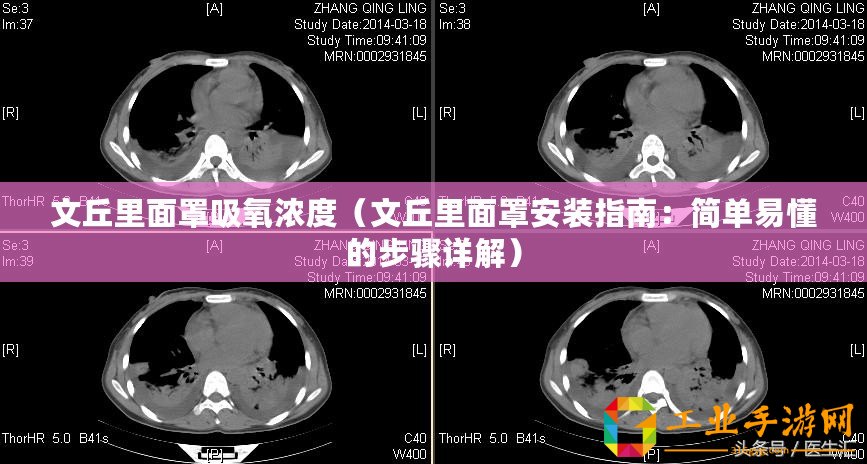 文丘里面罩吸氧濃度（文丘里面罩安裝指南：簡(jiǎn)單易懂的步驟詳解）